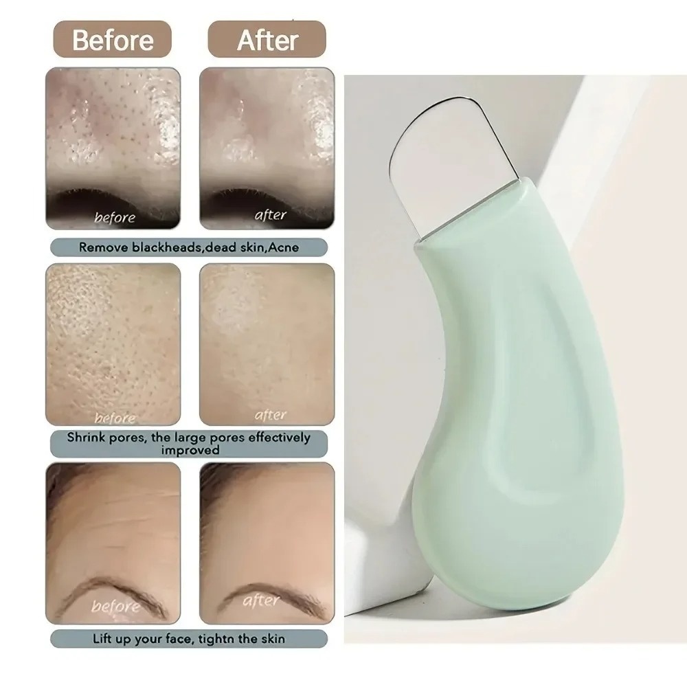 Ferramenta de Limpeza Profunda - Skincare Routine avaliação e preço